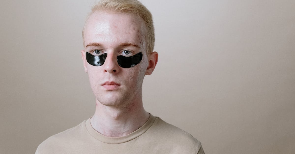 découvrez comment une alimentation adaptée peut aider à réduire l'acné et améliorer la santé de votre peau grâce à notre guide sur le régime anti-acné.